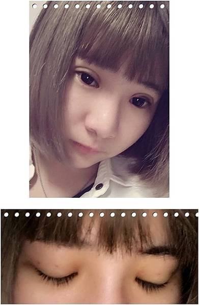 台北自然魅力訂書針雙眼皮診所