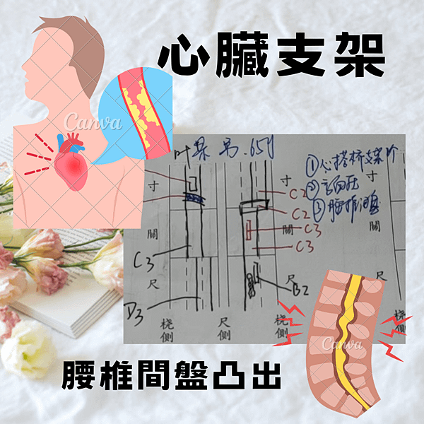 心支架腰椎盤(2).png