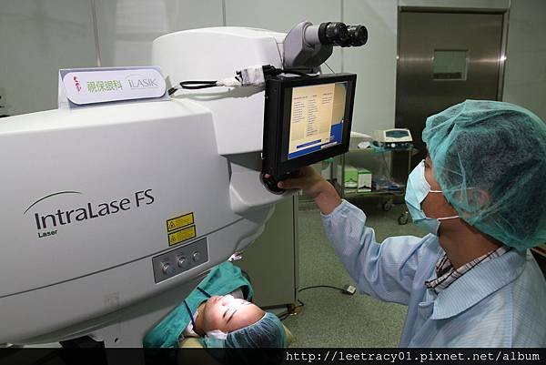 視保眼科飛秒無刀雷射製作穩定崁入式角膜瓣，不易移位、恢復快，減少近視雷射術後乾眼.jpg