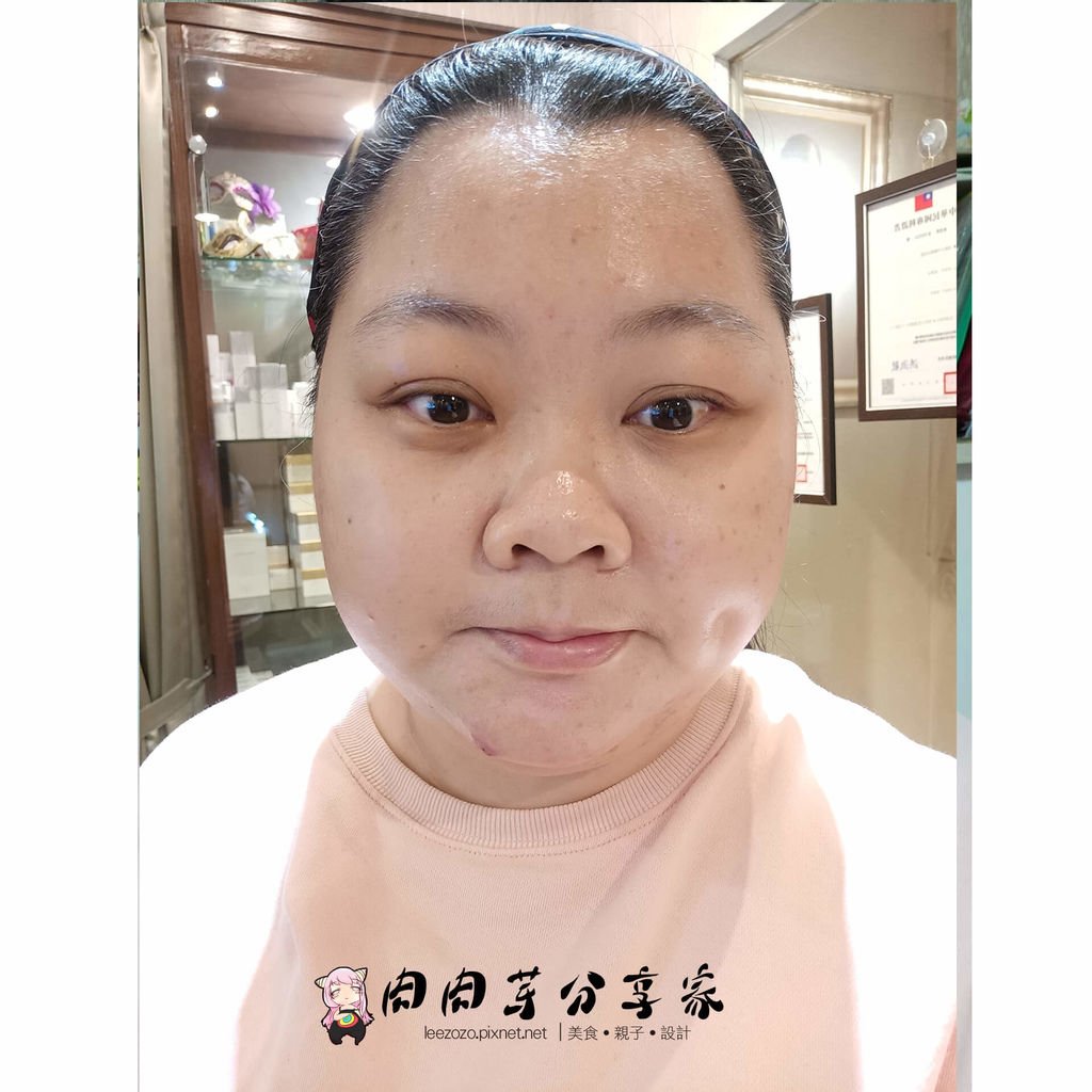 喬瑜美容 後.jpg