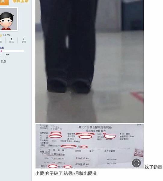202405又有高級會員因套子破掉被勁量小愛得愛滋