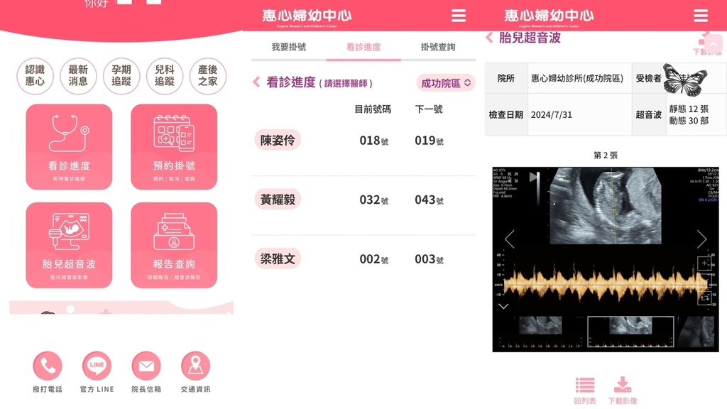 三重婦幼醫院推薦《惠心婦產科小兒科診所》例行產檢＋乳房超音波