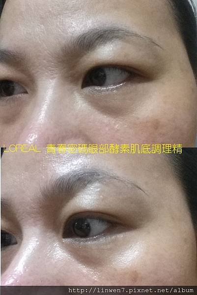 LOREAL 青春密碼眼部酵素肌底調理精萃.jpg