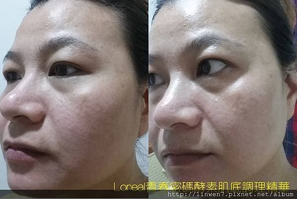 Loreal青春密碼酵素肌底調理精華.jpg