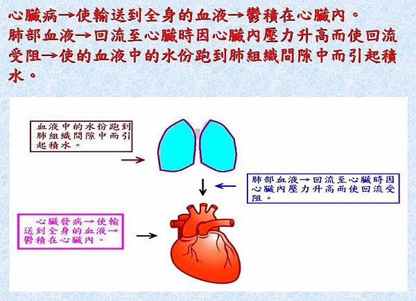 20170117肺水腫肺積水3.JPG