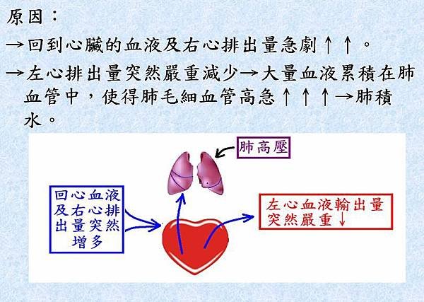 20170117肺水腫肺積水2.JPG