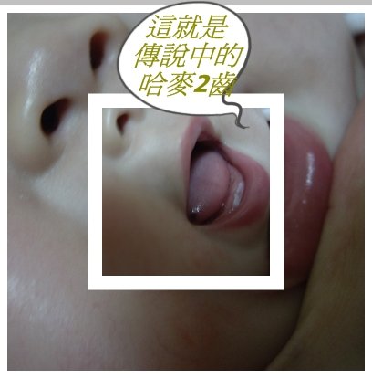 哈麥2齒.jpg