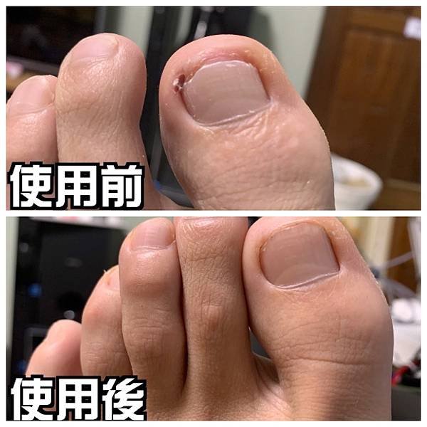 前後.jpg
