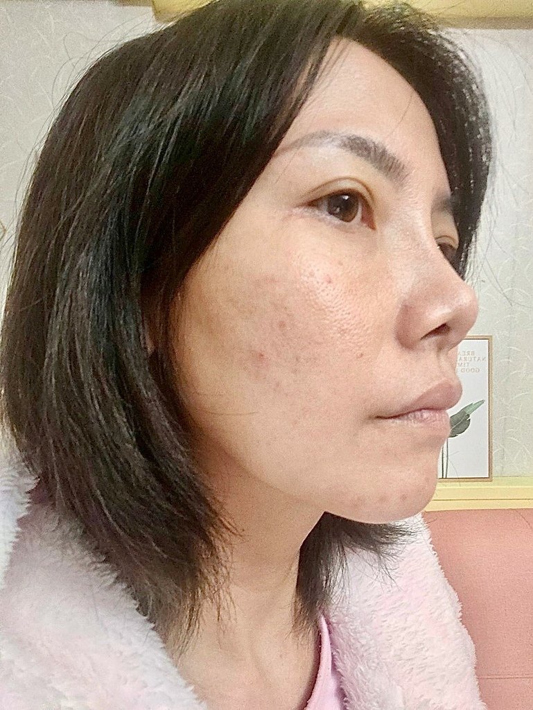 Acne Repair Gel 美無痕抗痘修護凝膠圖片_220609_0_0.jpg