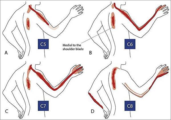 cervical-pain.jpg