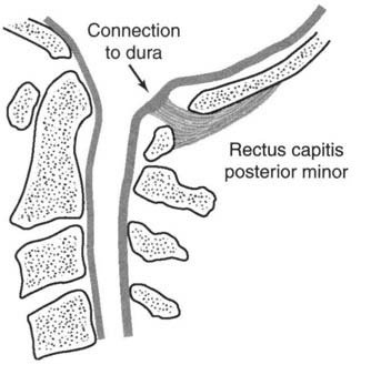 Rectus Capitis Posterior Minor.jpg