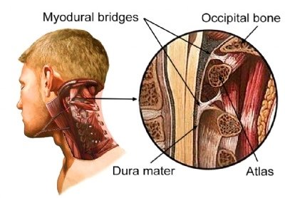 myodural bridge.jpg