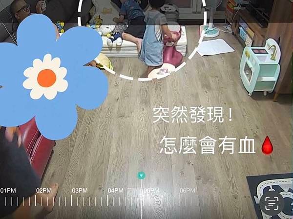 2024/06/30。小吐司急診縫合及後續記錄