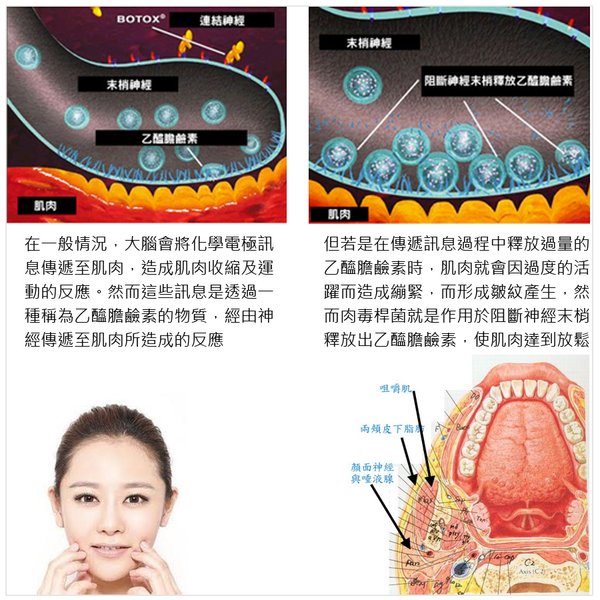 凝膠式玻尿酸豐唇肉毒桿菌瘦小臉G