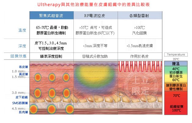 超音波拉皮Ulthera極線音波拉皮極限音波拉皮筋膜拉皮超音波拉皮電波拉皮06