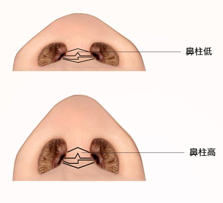 液態拉皮3D聚左旋乳酸舒顏萃全臉體積矯正玻尿酸隆鼻晶亮瓷微晶瓷隆鼻01