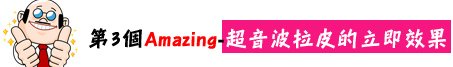 林上立 推薦 液態拉皮 推薦 極線音波拉皮 推薦 極限音波拉皮 推薦 筋膜拉皮 推薦 超音波拉皮 推薦 超音波拉皮 推薦09