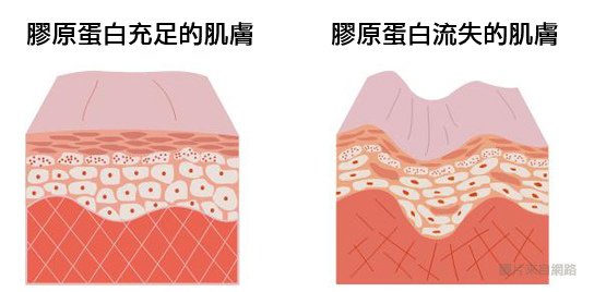 膠原蛋白膠原蛋白粉超音波拉皮極線音波拉皮電波拉皮液態拉皮