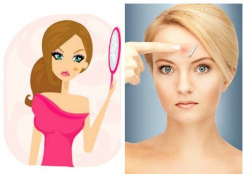 500x885xredness-pimple-remedy.jpg.pagespeed.ic.so1cU4h0uO