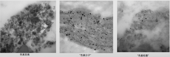 PicoSure蜂巢皮秒機械光雷射除皺雷射皮秒雷射除皺細紋凹疤雀斑曬斑斑點肝斑淨膚雷射飛梭雷射上立皮膚科診所4.png