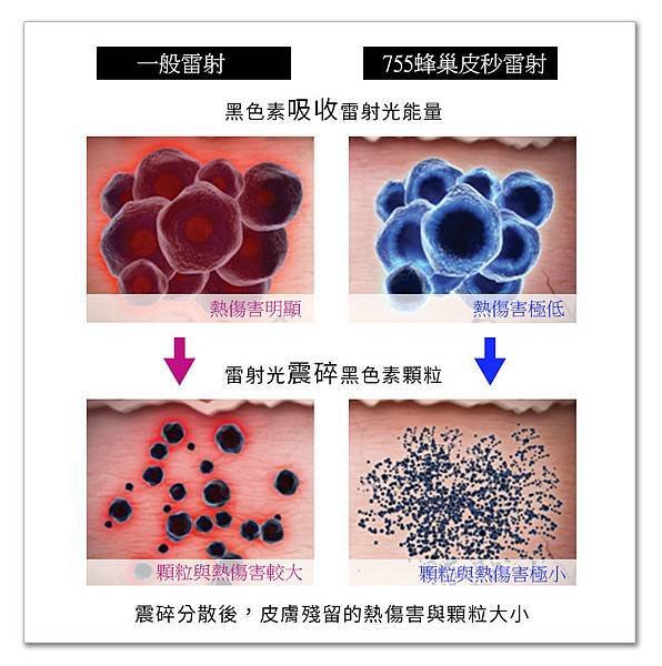 755蜂巢皮秒雷射Picosure皮秒機械光雷射范冰冰雷射飛梭雷射淨膚雷射5