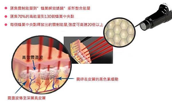 PicoSure蜂巢皮秒除皺雷射 除皺雷射 蜂巢皮秒機械光755雷射 淨膚雷射蜂巢瞬效透鏡 蜂巢皮秒機械光雷射PicoSure皮秒雷射雀斑曬斑 細紋眼下細紋毛孔粗大飛梭雷射縮毛孔淨膚雷射皮秒雷射價格皮秒雷射價錢皮秒雷射凹洞皮秒雷射除斑皮秒雷射刺青11