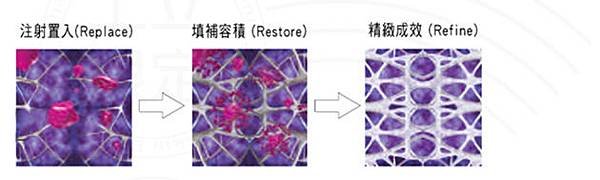 上立皮膚科 費用 林上立 價格 林上立 評價  液態拉皮上立提 液態拉皮 推薦 3D聚左旋乳酸 舒顏萃 童顏針 液態拉皮 推薦 3D聚左旋乳酸 舒顏萃 童顏針 3D聚左旋乳酸 價格 3D聚左旋乳酸 費用 Sculptra08