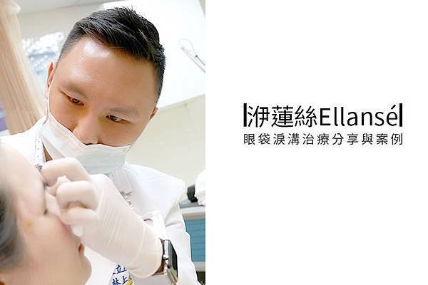 少女計劃林上立醫生液態拉皮上立提 液態拉皮 推薦 Ellansé 洢蓮絲少女針PolycaprolactonePCL膠原增生劑易麗適依戀詩聚己內酯.jpg