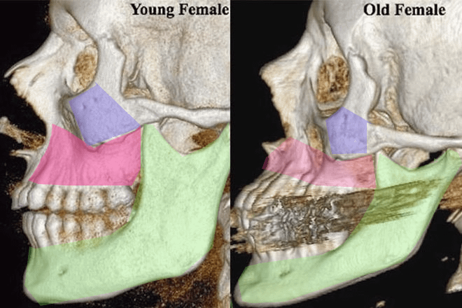 facial-bones-110105-02.png