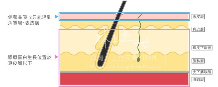 林上立醫生液態拉皮上立提Ellansé 洢蓮絲少女針PolycaprolactonePCL膠原增生劑易麗適依戀詩聚己內酯埋線拉皮3D聚左旋乳酸童顏針舒顏萃皮秒雷射755皮秒雷射蜂巢透鏡蜂巢皮秒雷射02.jpg