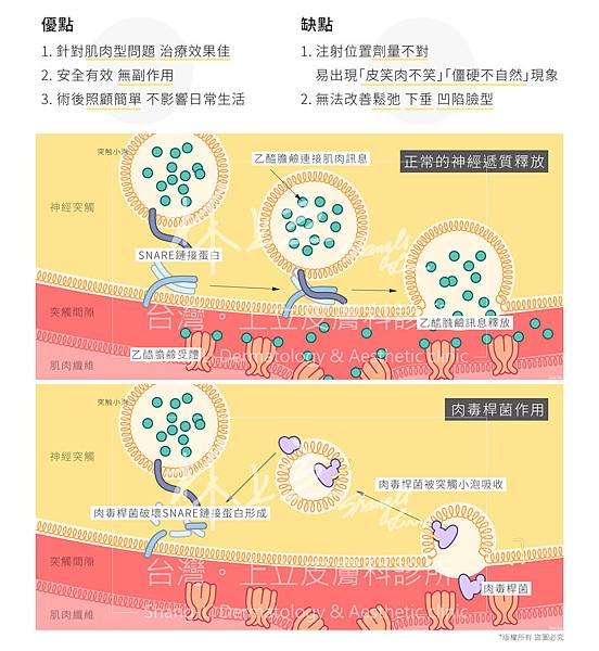 上立皮膚科肉毒桿菌botox咀嚼肌法令紋皺紋凹陷填補林上立醫師 (2).jpg