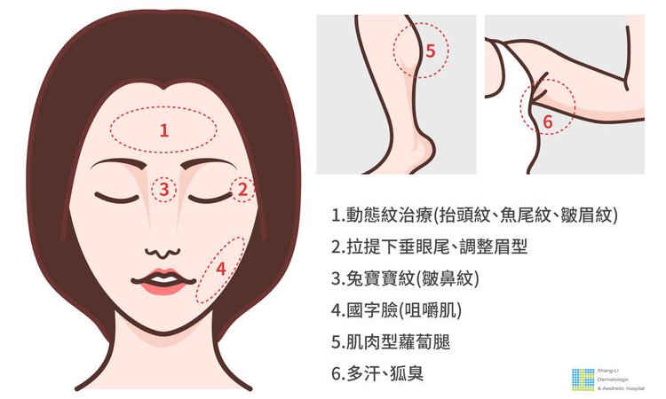 上立皮膚科肉毒桿菌botox咀嚼肌法令紋皺紋凹陷填補林上立醫師 (4).jpg