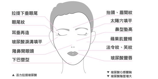 玻尿酸施打部位