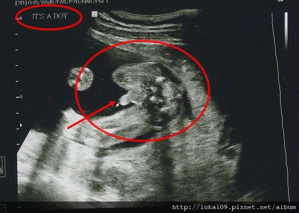 20 week Ultrasound - it&apos;s a boy.jpg