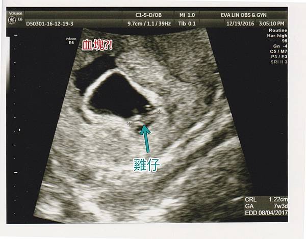 ultrasound1219-2.jpg