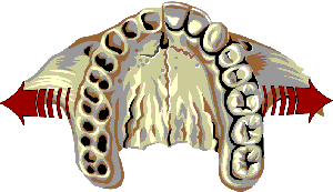 maxilla1