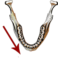 mandible1