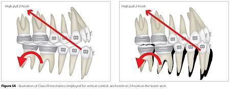 a26fig14