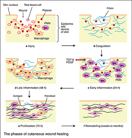 woondHealing_phases_of_cutaneous