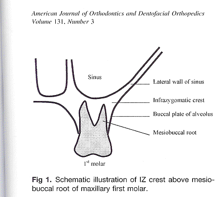 IZA%20anatomy%201