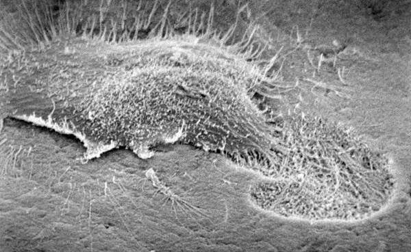 arnett_osteoclast