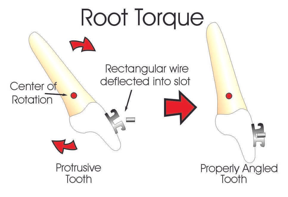 Root-Torque.jpg