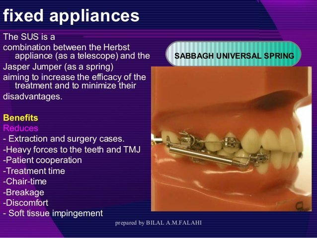 myofunctional-appliances-in-orthodontic-61-638.jpg