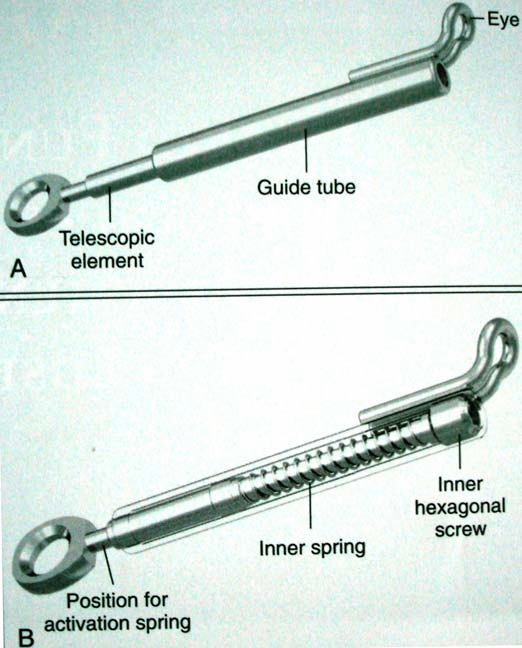 Fig-4-The-Sabbagh-Universal-Spring-2-SUS-2-A-Telescopic-rod-is-fitted-into-the.png