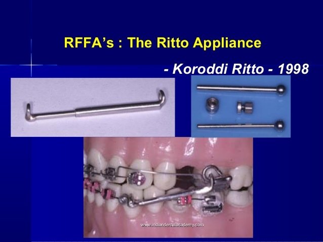 fixed-functionals-appliance-certified-fixed-orthodontic-courses-by-indian-dental-academy-14-638.jpg