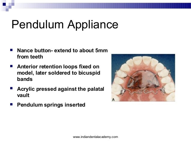 molar-distalization-certified-fixed-orthodontic-courses-by-indian-dental-academy-50-638.jpg