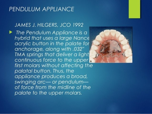 molar-distalisation-40-638.jpg