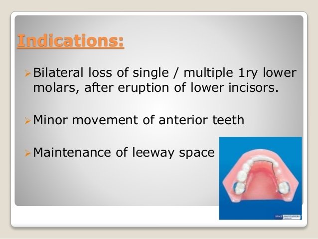 lingual-arch-space-maintainer-4-638.jpg