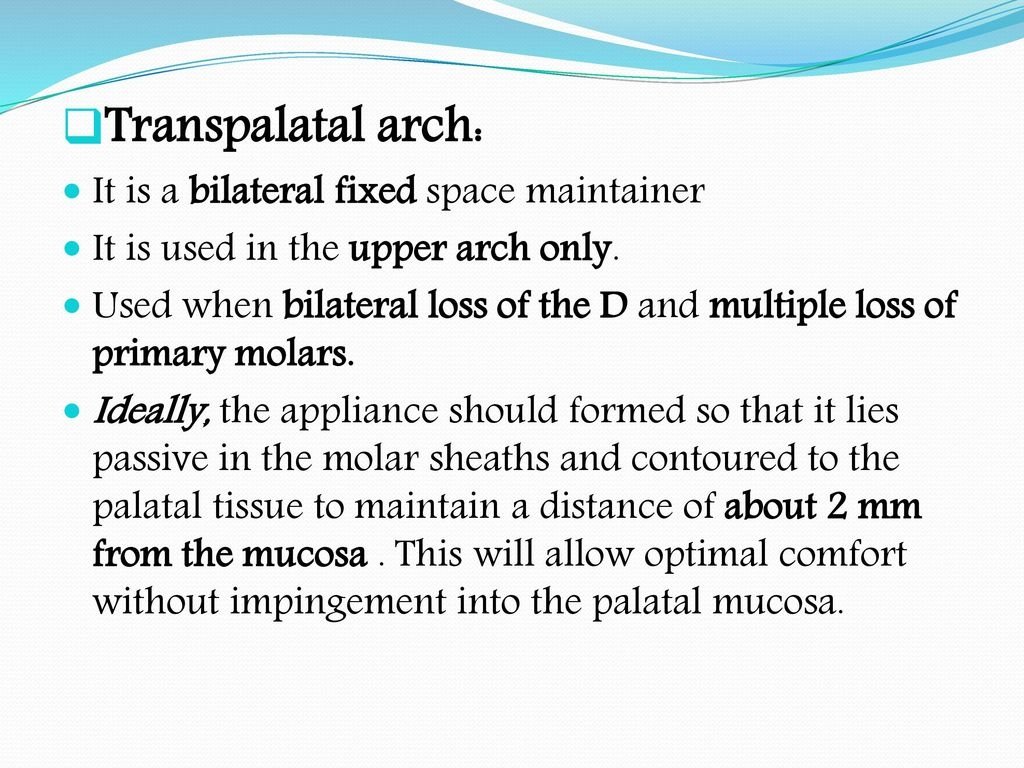 Transpalatal+arch +It+is+a+bilateral+fixed+space+maintainer.jpg