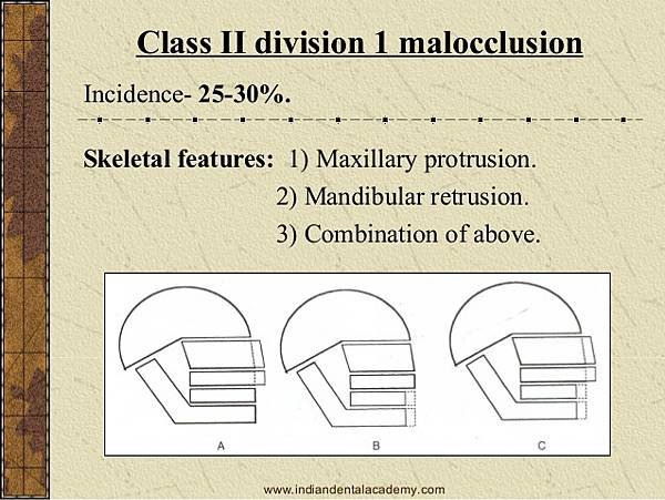 class-2-malocclusion-certified-fixed-orthodontic-courses-by-indian-dental-academy-5-638.jpg